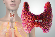 Concept Endocrine System Disorders