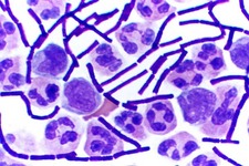 Concept Harmful Bacteria