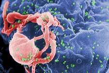 Concept HIV
