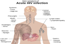 Concept Immunodeficiency