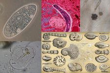 Concept Protist Kingdom