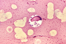 Concept Protozoa