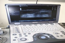 Concept Ultrasound