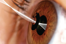 Concept Vision and the Eye