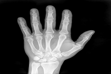 Concept X rays